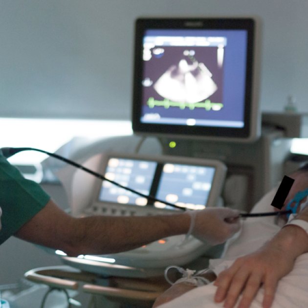 Ecocardiograma con Dobutamina en el Instituto Cardiovascular de Concepción