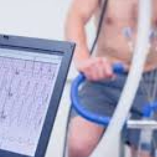 Test de Esfuerzo (Ergometría) en el Instituto Cardiovascular de Concepción